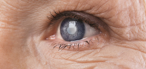 GLAUCOMA