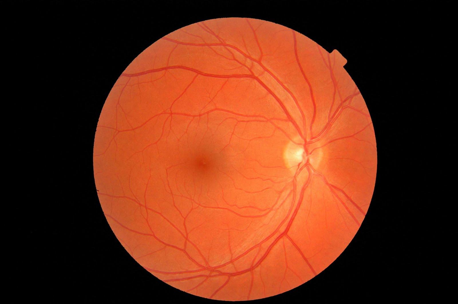 RETINOGRAFIA